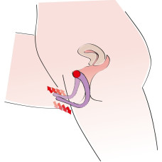 Стимулятор G-точки - G-spot Labia Spreader