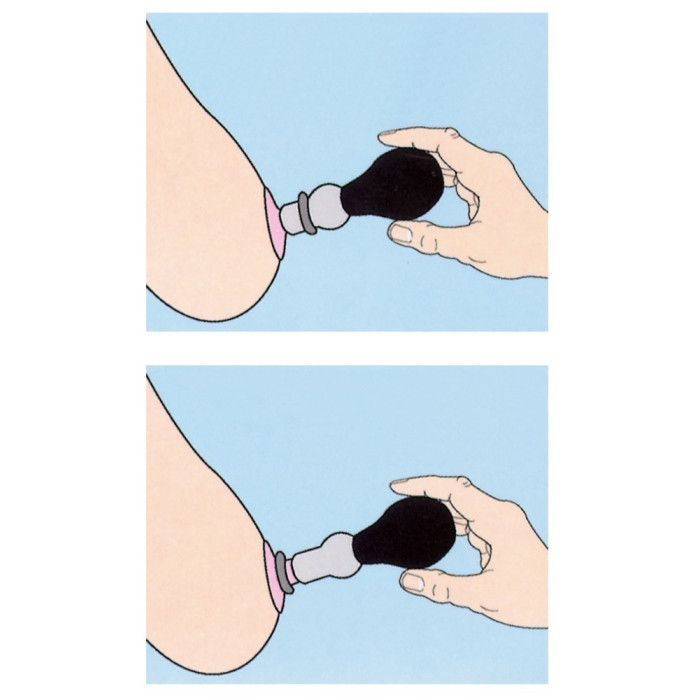 Вакуумна помпа - Nipple Pump